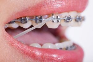 Zahnärztliche Behandlung - Zahnarzt KFO